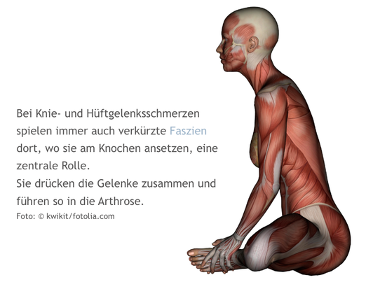 Knie, Hüfte, Schmerzen, Arthrose, Liebscher-Bracht, Globuli, Homöopathie, LNB, Osteopressur